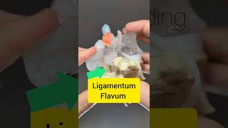 Ligamentum Flavum Modelling  Dynamic Disc Designs [upl. by Raddie]