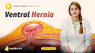 Ventral Hernia  General Surgery Video Lecture  Doctors VLearning  sqadiacom [upl. by Nylodnarb127]