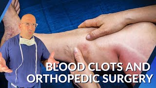 Blood Clots and Orthopedic Surgery [upl. by Dusza]