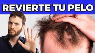 Una Guía Simple para Frenar Tu CAÍDA de Cabello [upl. by Aztiley]