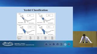 The Impact of Portal Vein Thrombosis Grade and PostReperfusion Flow Rate in Liver Transplants [upl. by Samtsirhc]