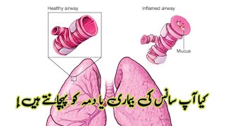 Asthma Kya Hota Hai  Dama Ka Ilaj In Urdu  sans ki bimari ka ilaj [upl. by Bryna]