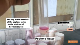 Indole production by E coli in peptone water [upl. by Kaden]