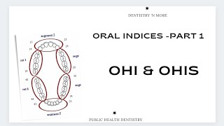 DENTAL INDICES  OHIamp OHISPART 1 [upl. by Eiramave]