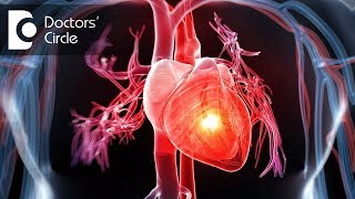 How to manage breathlessness in cardiac patients with a stent  Dr Durgaprasad Reddy B [upl. by Yauqram171]