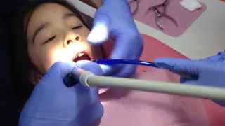 5 minutes SpaceMaintainer By Dr Idlibi Kids Dental Care [upl. by Sidnac205]