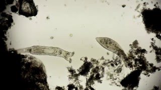 Rädertierchen und Pantoffeltierechen  Rotifer vs Paramecium  microorganisms under microscope [upl. by Itsud]