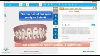 The Invisalign Clincheck Process from start to final approval video [upl. by Aettam17]