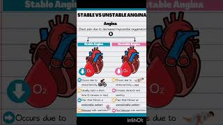 ANGINA  TYPES OF ANGINA shorts viralvideo youtubeshorts aiapget neetpg [upl. by Ojimmas]