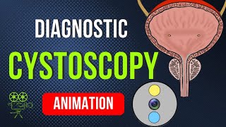 DIAGNOSTIC CYSTOSCOPY ANIMATION [upl. by Anul870]