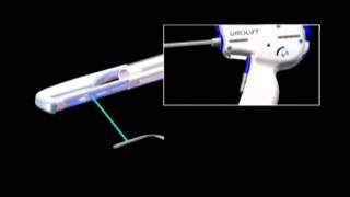 The UroLift® System Device Deployment [upl. by Gulgee]