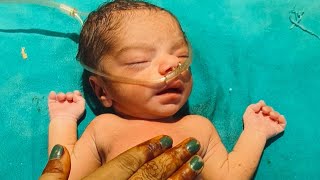 The condition of the newborn baby is very serious he is not crying नवजात शिशु की हालत बहुत गंभीर है [upl. by Buffy11]