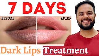 7 Days Dark Lips Removal Challenge  Pigmented Lips Treatment [upl. by Lorn417]