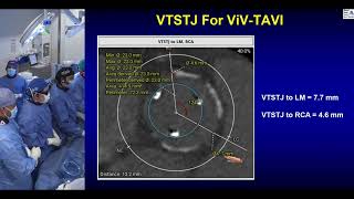 Live Structural Case India  June 2024 [upl. by Melodie]