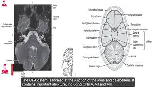 Brain anatomy 🧠 03subarachnoid cisterns [upl. by Akaenahs763]