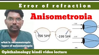 anisometropia  error of refraction  what is anisometropia  anisometropia  optometryhindi [upl. by Narcissus]