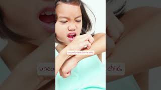 Seborrheic Dermatitis in Children Advices and Solutions babyhealth seborrheicdermatitis [upl. by Eyr]