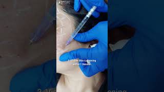 Face Mesotherapy for a rejuvenated skin AntiAgeing Treatment for face [upl. by Olwen558]