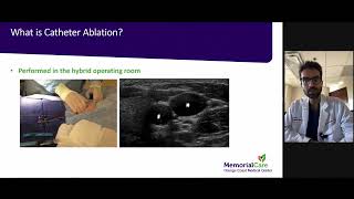 Convergent Procedure for Atrial Fibrillation AFib [upl. by Mccully]