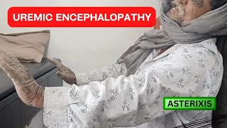 HOW TO MANAGE UREMIC ENCEPHALOPATHY  SIGNS  SYMPTOMS  CKD TREATMENT BY MD MEDICINE DOCTOR [upl. by Enineg]