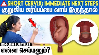 Short cervix  Preterm labor  Cervical stitch  How they are related  குறுகிய கர்ப்பப்பை வாய் [upl. by Uile33]