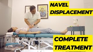 Chiropractic Adjustment for Umbilical or Navel Displacement Restoring Balance and Alleviating Pain [upl. by Teemus547]