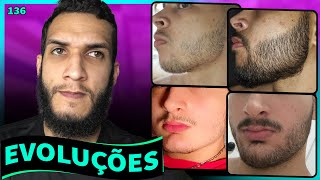 EVOLUÇÕES COM MINOXIDIL  BARBA ANTES E DEPOIS 136 [upl. by Nowyt]