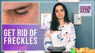 How to Get Rid of Freckles Permanently  Remedies for Dark Spots  Juggun Kazim  Beauty [upl. by Nywles]