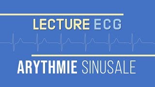 Interprétation ECG  Arythmie Sinusale [upl. by Enylcaj]