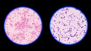 Staining technique in microbiology Gram staining [upl. by Nugent]