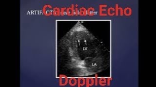 Echocardiogram  Basic physics and instrumentation  Fundamentals [upl. by Bandeen342]