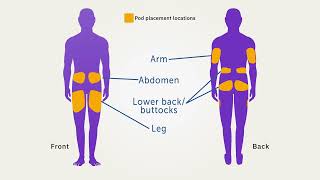 Omnipod® 5 Automated Insulin Delivery System Product Training  Pod Activation [upl. by Dibrin]