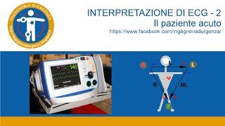 Interpretazione di ECG  2 lelettrocardiogramma nel paziente acuto [upl. by Toddy987]