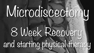 Microdiscectomy Recovery  8 Weeks and starting Physical Therapy [upl. by Sokim]