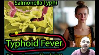 Typhoid Fever Symptoms Causes and treatment [upl. by Sullivan296]