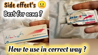 How to Use skinA cream Skin A cream uses amp side effects Skin A cream Review fahasstylediary09 [upl. by Eelta]