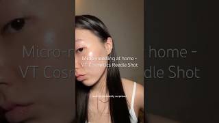 Microneedling at home for sensitive skin eczema rosacea koreanskincare kbeauty reedleshot [upl. by Ueihttam]