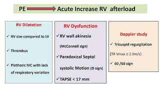 Lecture 5 Focused ECHO in Pulmonary Embolism [upl. by Obau]