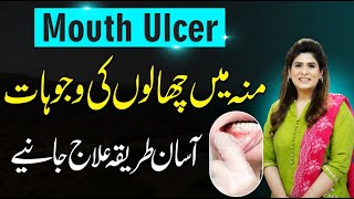 Mouth Ulcer Treatment  Muh Main Chale ka Ilaj  Dr Fareeha Tariq [upl. by Tildy]