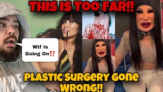 BEWARE Disturbing TRUTH About Woman With INSANE Plastic Surgery amp BOTCHED BBL That Went VIRAL On X [upl. by Malley]