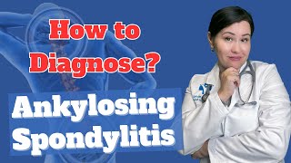 How to Diagnose Ankylosing spondylitis  Dr Diana Girnita [upl. by Annirac63]