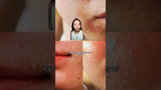 What damaged skin barrier could do to our skin medik8 [upl. by Mazurek909]