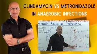 Clindamycin vs Metronidazole  Anaerobic Infections [upl. by Nnaeirual188]