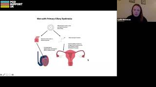 PCD Live Fertility and PCD  what do we know [upl. by Animor]