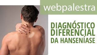 Webpalestra  Diagnóstico Diferencial da Hanseníase [upl. by Eceinahs]