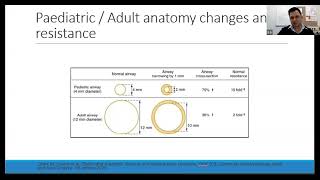 Acquired Paediatric Subglottic Stenosis  Dr Suraj Gaire [upl. by Aihsotal845]