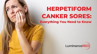 Herpetiform Canker Sores Everything You Need to Know [upl. by Chu]