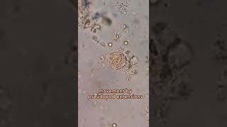 entamoeba histolytica locomotion pseudopodia amazing [upl. by Kozloski]