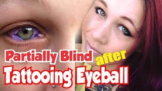 5 Things About Catt Gallinger Partially Blind After Tattooing of the Eyeball [upl. by Camarata217]