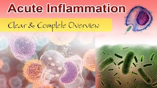 Acute Inflammation  Clear amp Complete Overview [upl. by Notlrac]